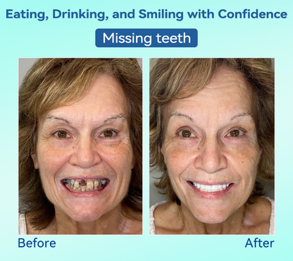 Natravor®🍀𝐏𝐫𝐞𝐦𝐢𝐮𝐦 𝐃𝐞𝐧𝐭𝐮𝐫𝐞(🦷𝐋𝐢𝐦𝐢𝐭𝐞𝐝 𝐭𝐢𝐦𝐞 𝐝𝐢𝐬𝐜𝐨𝐮𝐧𝐭 𝐋𝐚𝐬𝐭 𝟑𝟎 𝐦𝐢𝐧𝐮𝐭𝐞𝐬🦷)