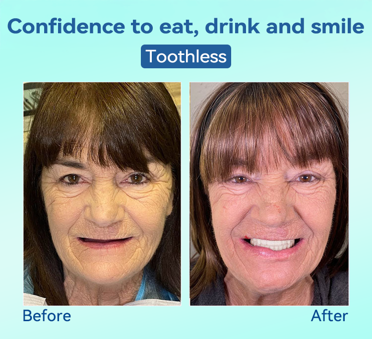 Natravor®🍀𝐏𝐫𝐞𝐦𝐢𝐮𝐦 𝐃𝐞𝐧𝐭𝐮𝐫𝐞(🦷𝐋𝐢𝐦𝐢𝐭𝐞𝐝 𝐭𝐢𝐦𝐞 𝐝𝐢𝐬𝐜𝐨𝐮𝐧𝐭 𝐋𝐚𝐬𝐭 𝟑𝟎 𝐦𝐢𝐧𝐮𝐭𝐞𝐬🦷)