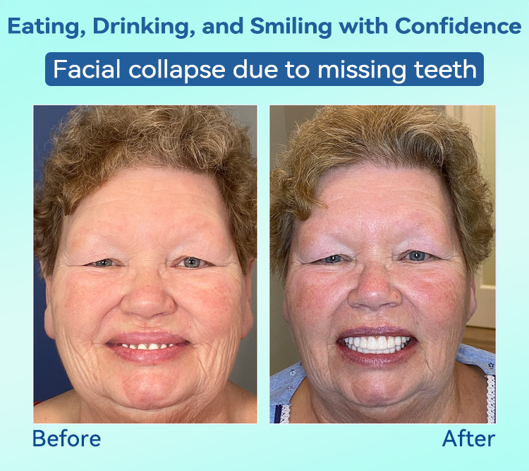 Natravor®🍀𝐏𝐫𝐞𝐦𝐢𝐮𝐦 𝐃𝐞𝐧𝐭𝐮𝐫𝐞(🦷𝐋𝐢𝐦𝐢𝐭𝐞𝐝 𝐭𝐢𝐦𝐞 𝐝𝐢𝐬𝐜𝐨𝐮𝐧𝐭 𝐋𝐚𝐬𝐭 𝟑𝟎 𝐦𝐢𝐧𝐮𝐭𝐞𝐬🦷)