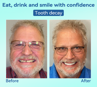 Natravor®🍀𝐏𝐫𝐞𝐦𝐢𝐮𝐦 𝐃𝐞𝐧𝐭𝐮𝐫𝐞(🦷𝐋𝐢𝐦𝐢𝐭𝐞𝐝 𝐭𝐢𝐦𝐞 𝐝𝐢𝐬𝐜𝐨𝐮𝐧𝐭 𝐋𝐚𝐬𝐭 𝟑𝟎 𝐦𝐢𝐧𝐮𝐭𝐞𝐬🦷)